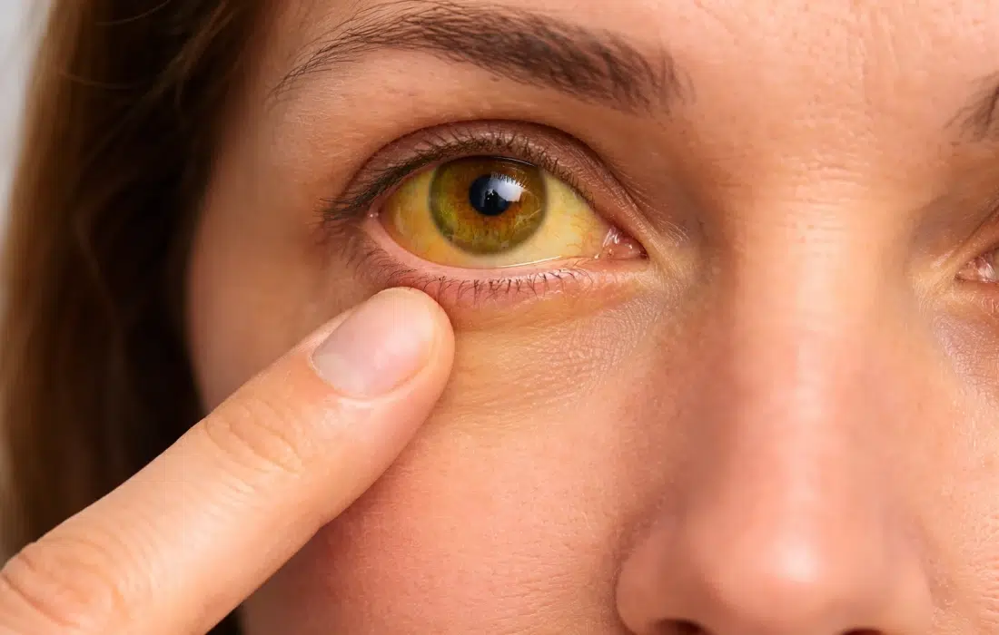 10 симптома на болен черен дроб, които не бива да пренебрегваме