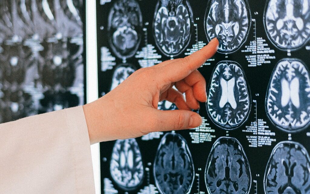  10 разлики сред мъжкия и женския мозък 